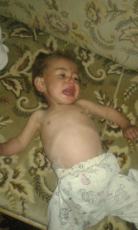 This image of a hungry child was posted on social media by an activist in the Syrian town of Madaya. CNN cannot independently verify the image.