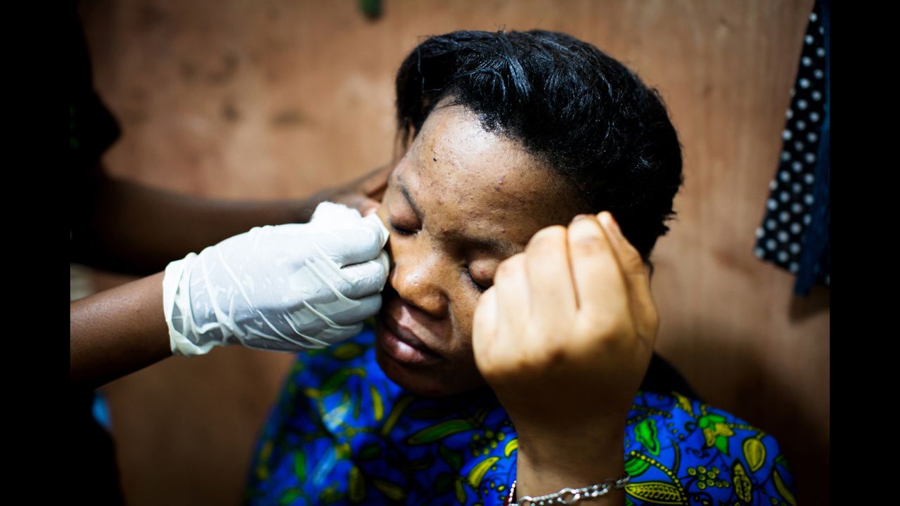 Ritah, an employee of a Mama Lususu salon in Kampala, Uganda, has her skin worked on by her colleagues. Ritah has extremely bleached skin with many infections, according to German photographer Anne Ackermann.