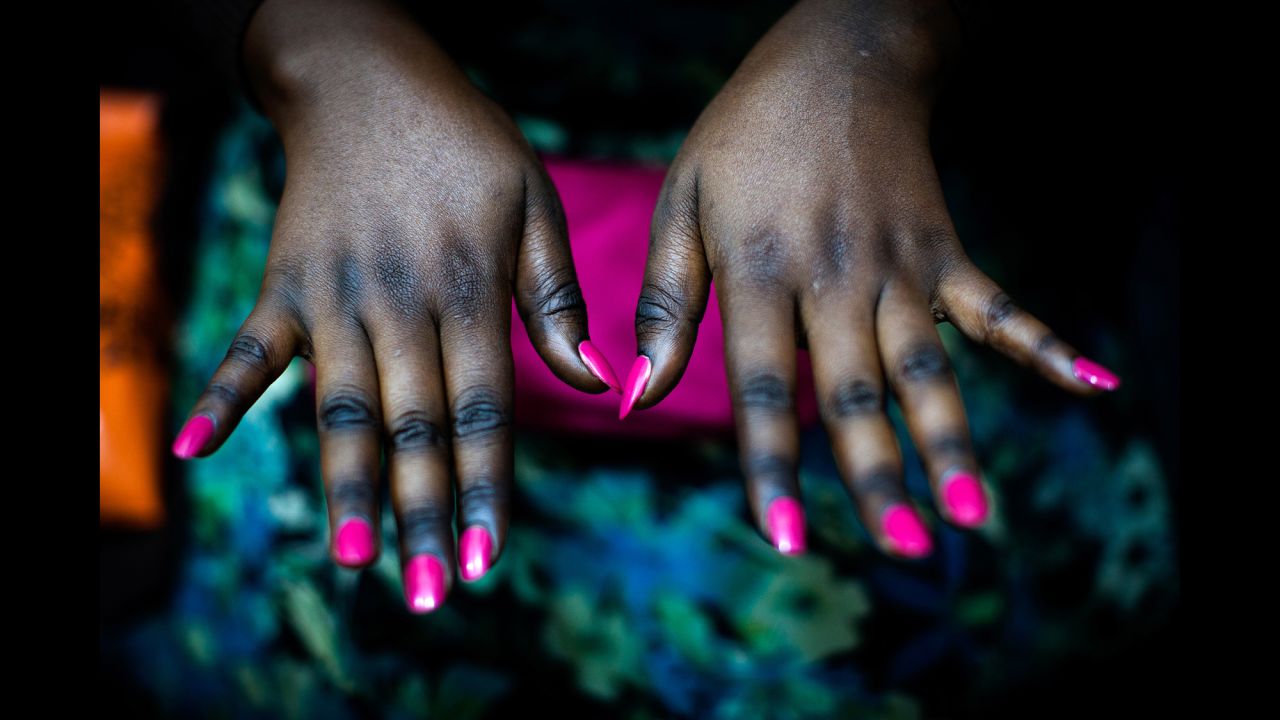 Jassinta shows her hands, which have a two-toned look. The skin on joints and ankles is thicker and therefore more difficult to bleach. Many women come to Mama Lususu's to specifically brighten the knuckles, feet and elbows, Ackermann said.