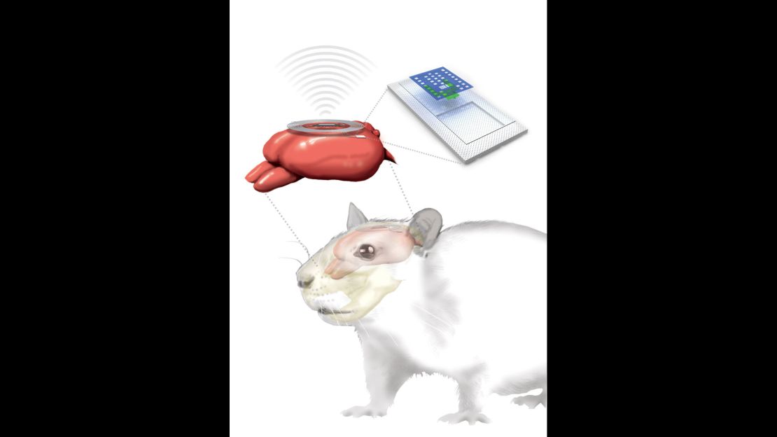 A schematic of the wireless system.