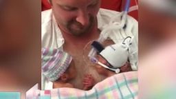preemie twins hold hands Daily Hit NewDay_00003719.jpg