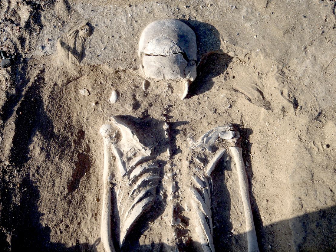 Man's skull has multiple lesions on the front and on the left side, consistent with wounds from a blunt implement.