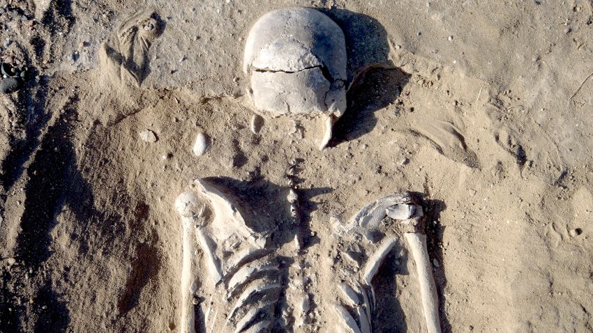 Skeleton KNM-WT 71255 after excavation. This skeleton was that of a man, found lying prone in the lagoon͛s sediments. The skull has multiple lesions on the front and on the left side, consistent with wounds from a blunt implement, such as a club. Image by Marta Mirazon Lahr, enhanced by Fabio Lahr