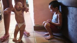 RECIFE, BRAZIL - JANUARY 25: David Henrique Ferreira (L), 5 months, who has microcephaly, is watched by his brother Richard Miguel on January 25, 2016 in Recife, Brazil. In the last four months, authorities have recorded close to 4,000 cases in Brazil in which the mosquito-borne Zika virus may have led to microcephaly in infants. Microcephaly results in newborns with abnormally small heads and is associated with various disorders including decreased brain development. According to the World Health Organization (WHO), the Zika virus outbreak is likely to further spread in South, Central and North America. At least twelve cases of Zika in the United States have now been confirmed by the CDC.  (Photo by Mario Tama/Getty Images)