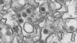 This is a transmission electron micrograph (TEM) of Zika virus, which is a member of the family Flaviviridae. Virus particles are 40 nm in diameter, with an outer envelope, and an inner dense core.