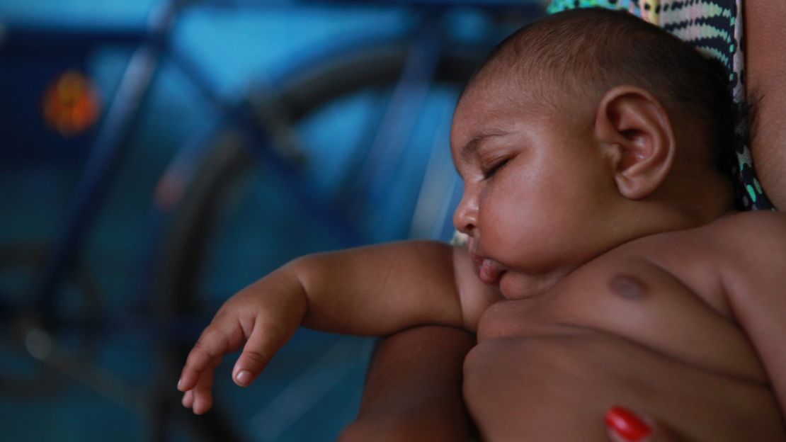 A number of Brazilian babies are being born with microcephaly.
