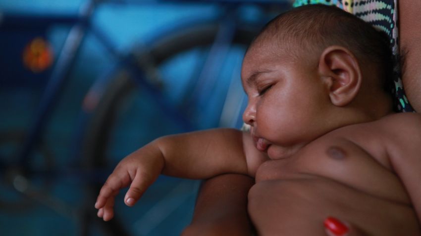 Luiz Felipe is one of more than 4000 babies born with microcephaly in Brazil since October.