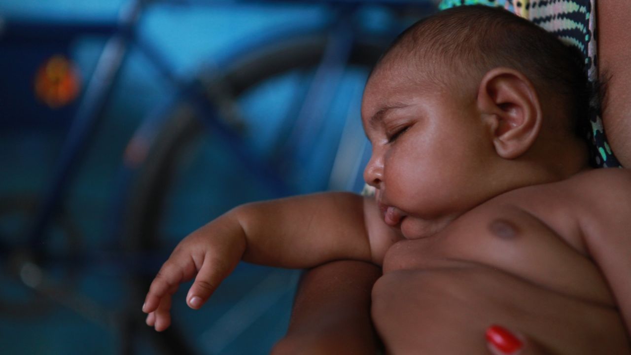 <a href="http://www.cnn.com/2016/01/27/health/the-children-of-zika/index.html" target="_blank">Luiz Felipe</a> lives in Recife and is one of more than 4,000 babies in Brazil born with microcephaly since October. The drought-stricken impoverished state of Pernambuco has been the hardest-hit, registering 33% of recent cases.
