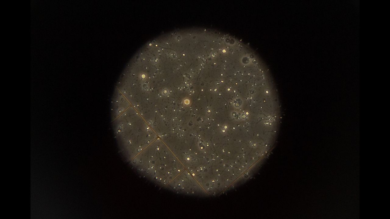 A microscopic view of sperm at Cryos.