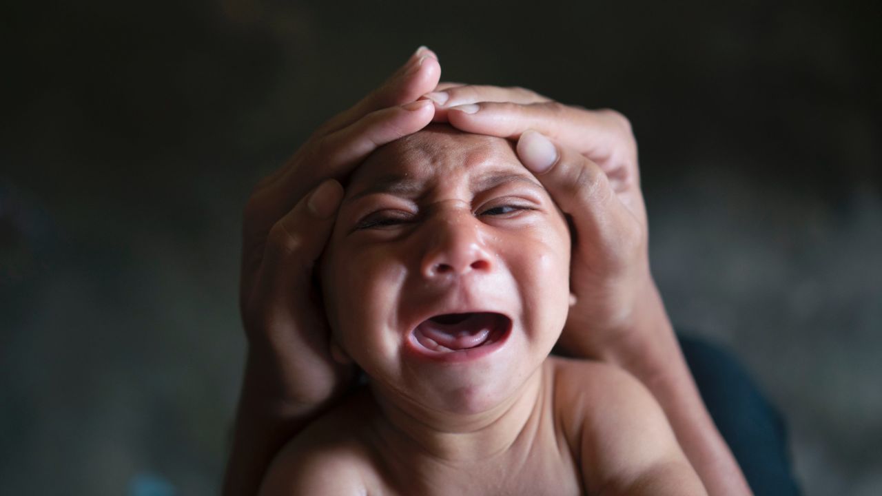 The older brother of Jose Wesley tries to calm the baby down in Bonito, Brazil, on Saturday, January 30. Jose Wesley was born with microcephaly, a neurological disorder that results in newborns with small heads and abnormal brain development. <a href="http://www.cnn.com/2016/01/26/health/gallery/zika-virus/index.html" target="_blank">An outbreak of the Zika virus</a> has been linked to a surge of babies with the birth defect. 