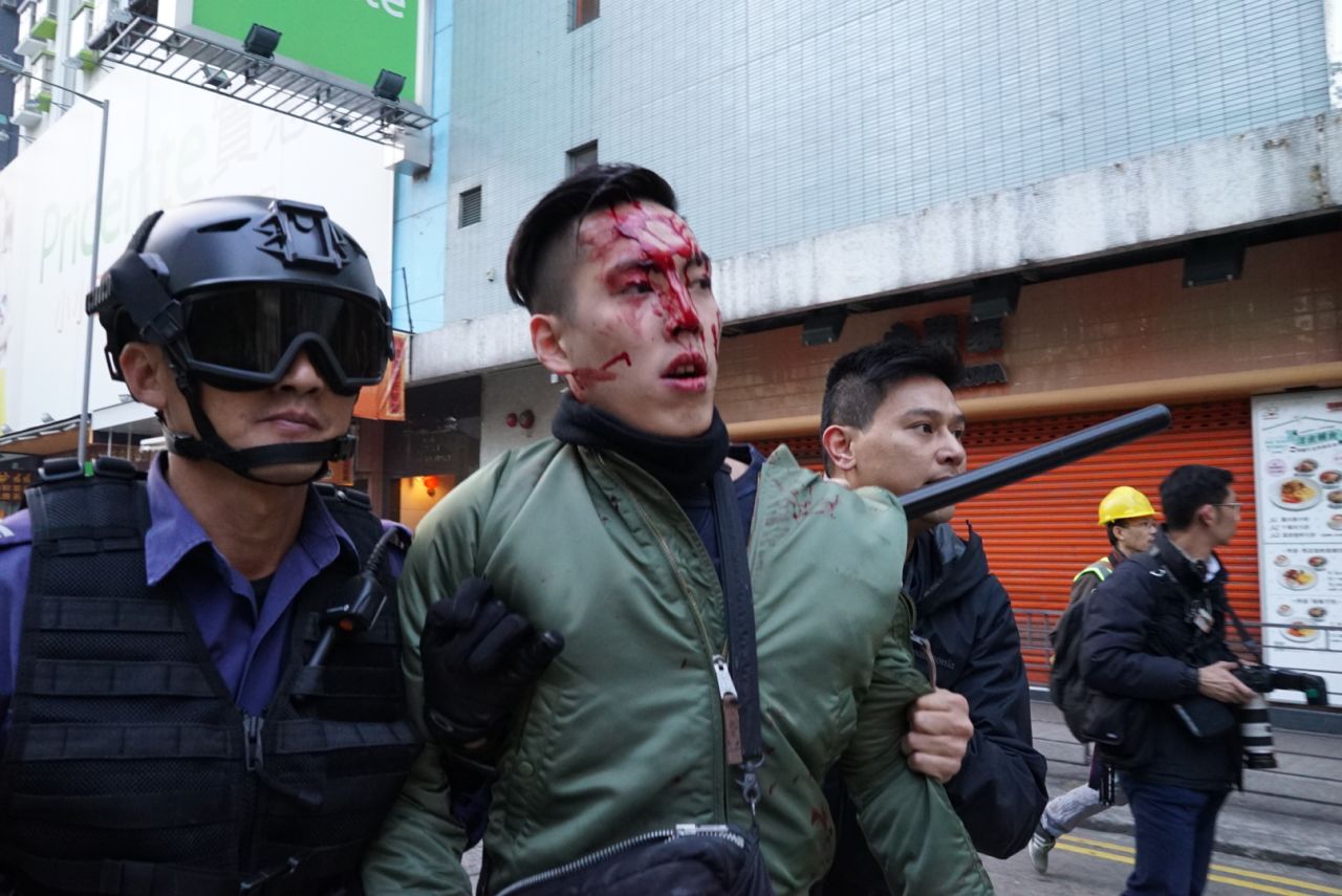 An injured protester is led away by an officer after police charged with batons.