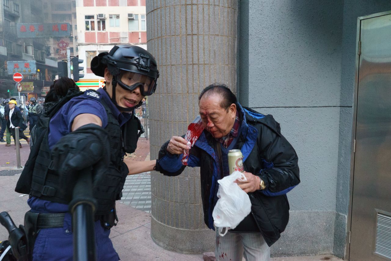 A man is bloodied after a police charge.