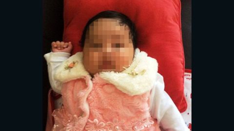 "Baby Asha" was sent to Australia for medical treatment but may be deported. 