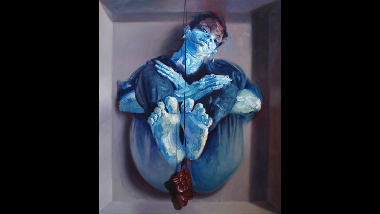 A human organ hangs in front of a body. The work is titled "In a Box."