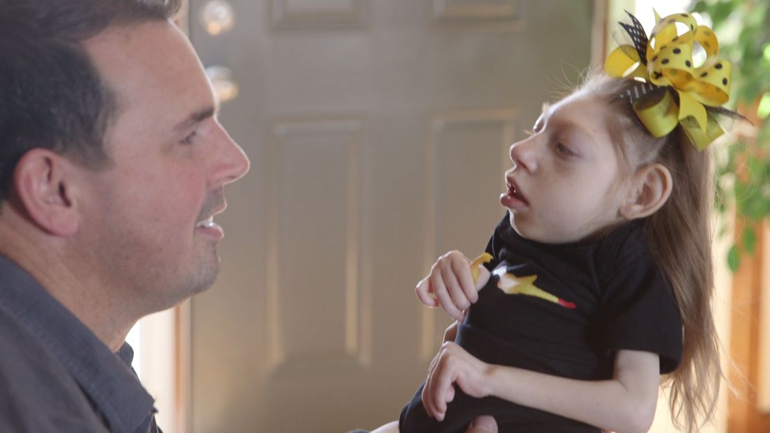 Scott Hartley holds his daughter Lola, who has microcephaly.
