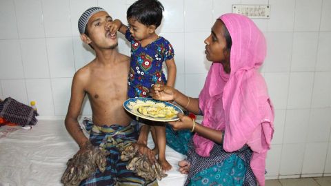 He cannot perform any activities by himself and relies on his 21-year-old wife, Halima, and their three-year-old daughter for help.