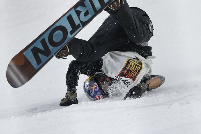 Mark McMorris of Canada (seen crashing at the Air + Style Beijing 2015 Snowboard World Cup) recently suffered a broken femur bone while attempting a frontside 1440 triple cork at the Air + Style event in Los Angeles. 