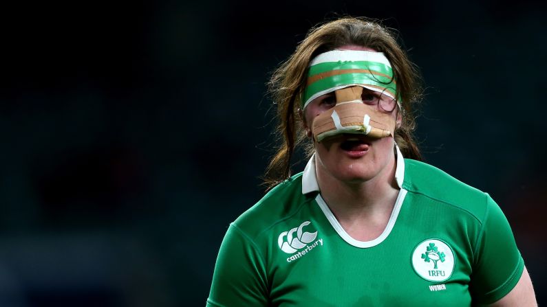 Irish rugby player Ailis Egan wears a protective mask during a Six Nations match against England on Saturday, February 27.