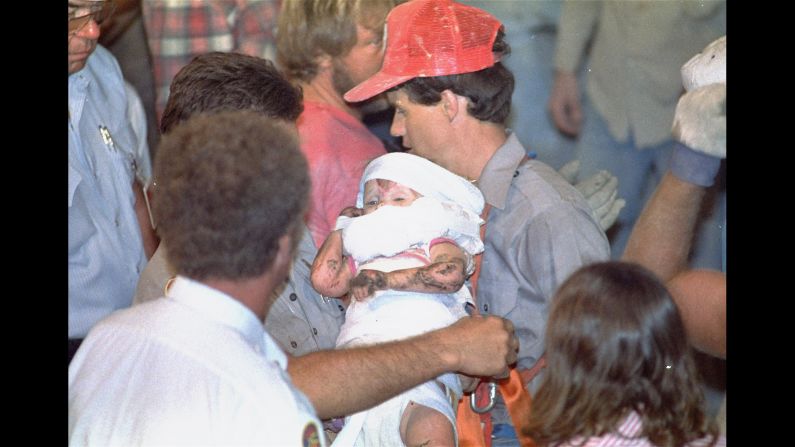 <strong>Baby Jessica:</strong> When an 18-month-old baby fell into an abandoned water well in her aunt's backyard in October 1987, millions of Americans spent three days glued to their televisions to see if she had been rescued. After being trapped 22 feet underground for three days, "Baby Jessica" -- as she was known by the end of the week -- was finally rescued on October 16, 1987.