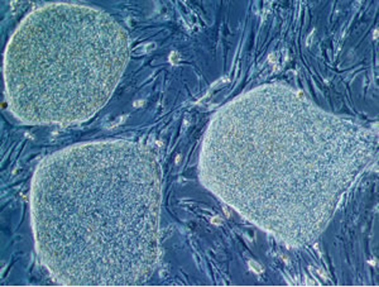 Stem cells offer the potential to be cultivated to become many other cell types in the body. Their ability to form cells within the eye could be key to reversing blindness. Pictured,  a colony of human embryonic stem cells under the microscope. 