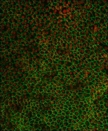 Cells in the eye's Retinal Pigmented Epithelium (REP) support the eye's vision center, the macula. Damage to these cells leads to deterioration of the macula, resulting in AMD. Pictured, retinal pigment epithelium (RPE) cells derived from human embryonic stem cells. 