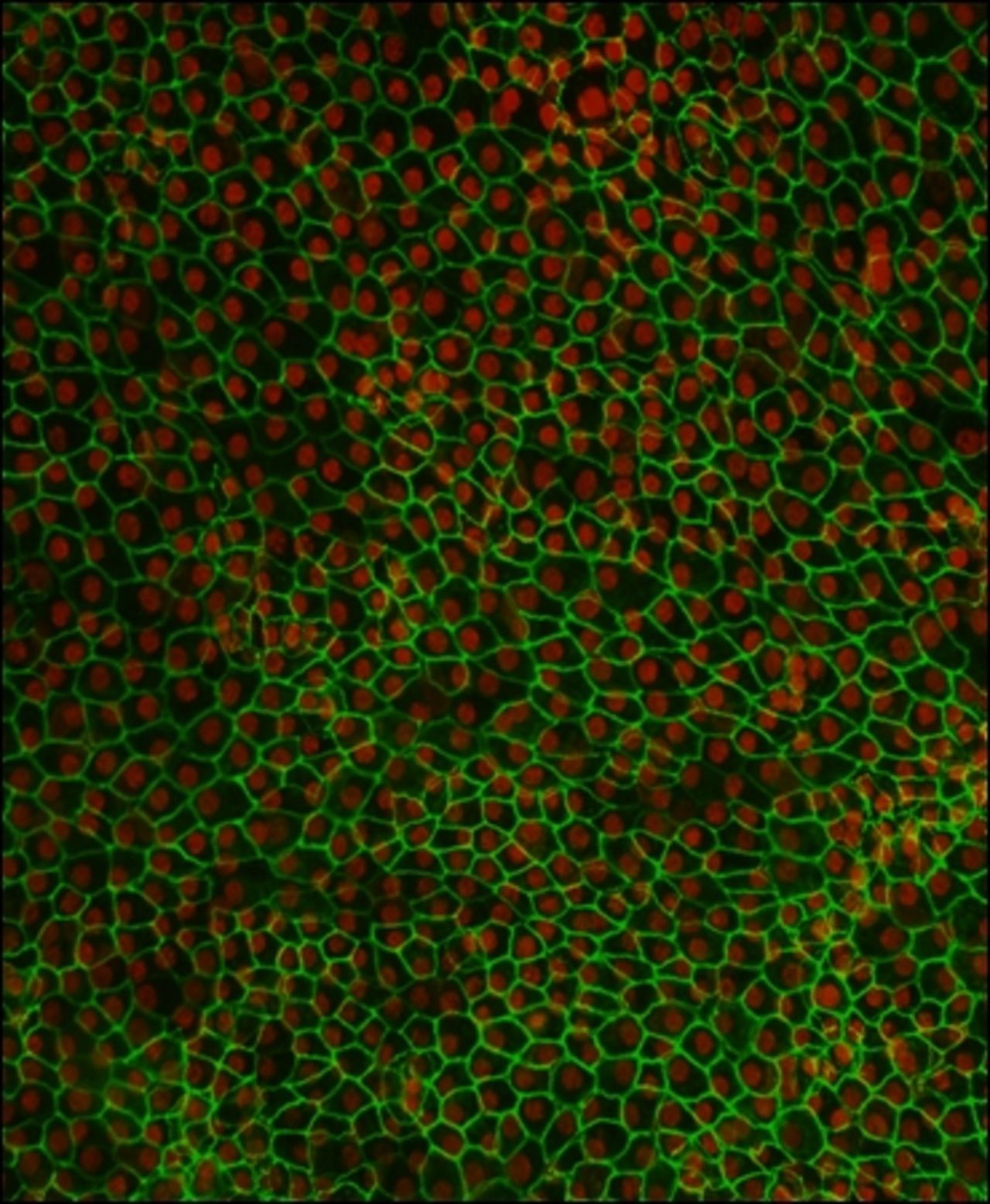 Cells in the eye's Retinal Pigmented Epithelium (REP) support the eye's vision center, the macula. Damage to these cells leads to deterioration of the macula, resulting in AMD. Pictured, retinal pigment epithelium (RPE) cells derived from human embryonic stem cells. 