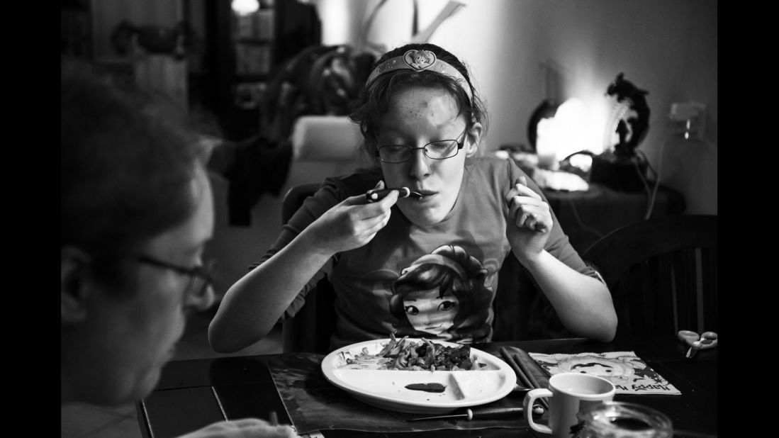 Suzanne Heijnen has Prader-Willi syndrome. The genetic disorder's most prominent symptom is an insatiable appetite -- you never feel full. Photographer Peggy Ickenroth spent two weeks with Suzanne and her family, hoping to learn more about the disease and how it affects people.