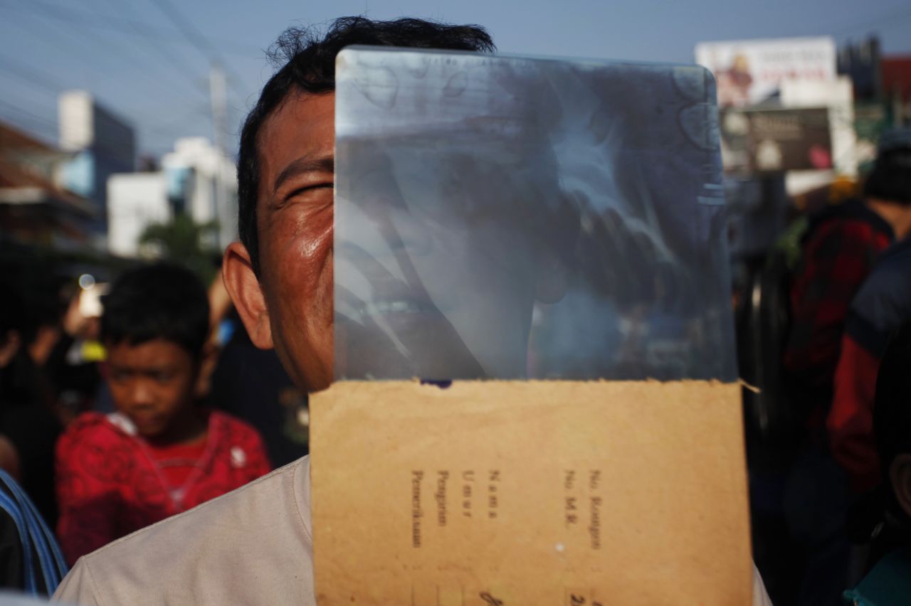 An Indonesian man watches the total solar eclipse using an X-ray film in Yogyakarta, Indonesia. 