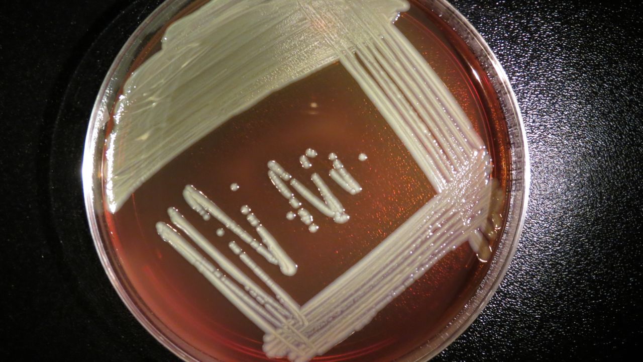 Elizabethkingia anophelis grows on a blood agar plate.