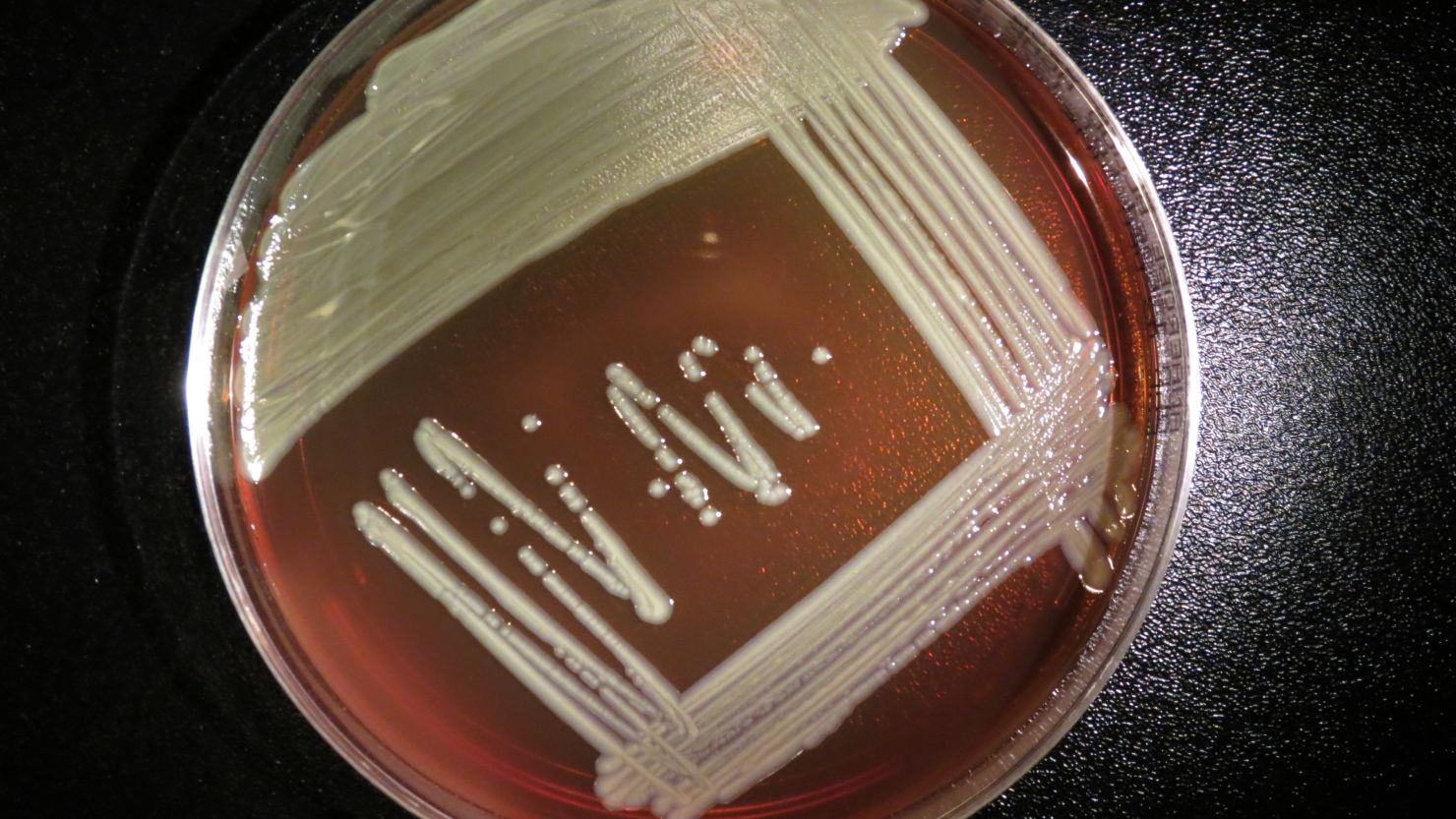 Elizabethkingia anophelis grows on a blood agar plate. It doesn't commonly cause illness in humans