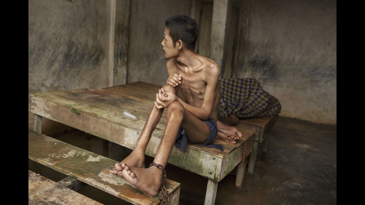 Before he died, this man lived chained to a platform at Kyai Syamsul's center in Brebes, Central Java. While there, his ankles swelled from constantly being shackled and his body became emaciated, according to<a href="https://www.hrw.org/node/287537/" target="_blank" target="_blank"> new report from Human Rights Watch.</a>