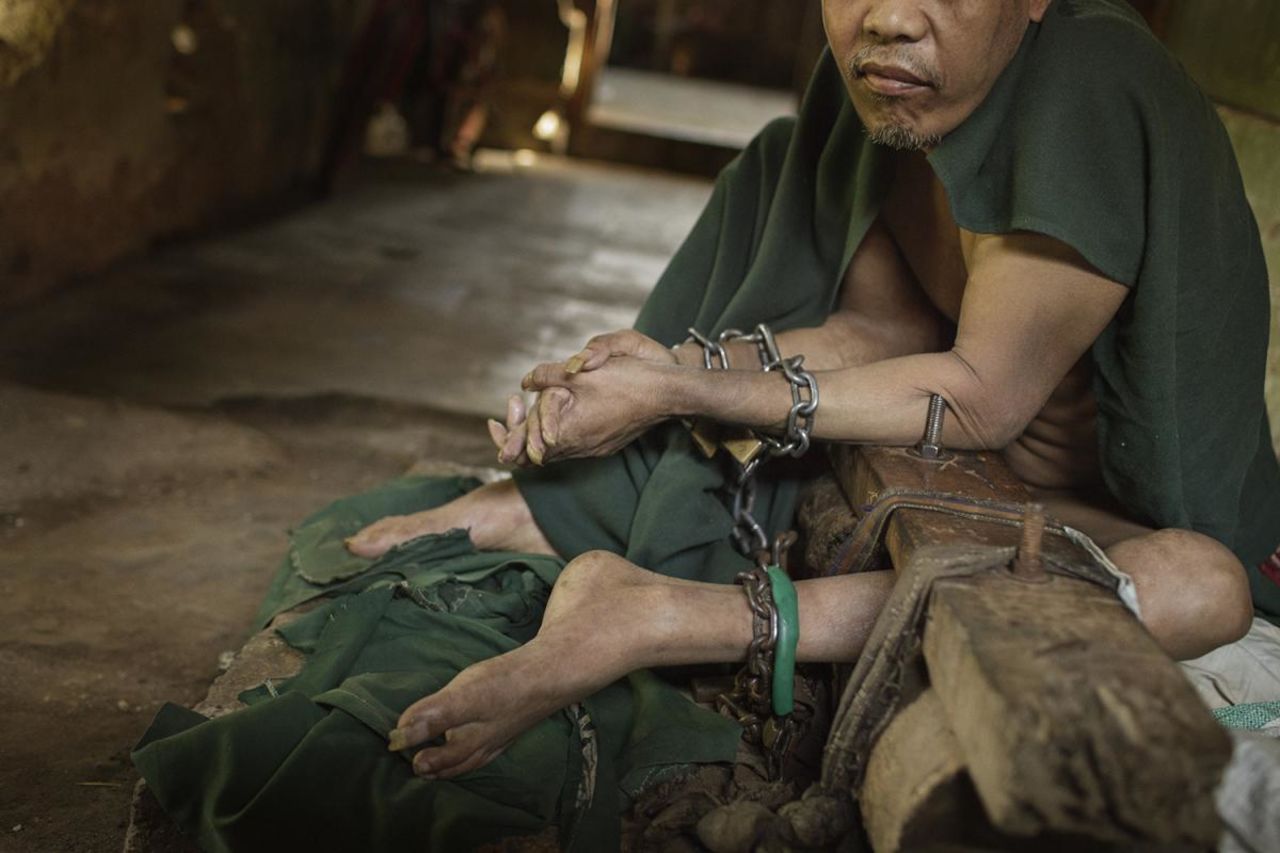 This man lived shackled in stocks for nine years in a back room in his family's home in Cianjur in West Java. When he was released, his legs had atrophied from disuse, HRW said.