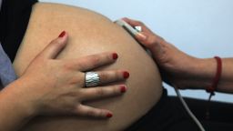 Rayen Luna Solar, 27, 33-week pregnant, is seen by a midwife in a routine checkup, in Santiago, on July 13, 2012. In Chile 38 percent of the births are carried out by caesarean section --with up to 60 percent in private hospitals-- the third highest rate in Latin America, following Brazil and Mexico, and is the country's most frequent surgery. AFP PHOTO/Claudio Santana (Photo credit should read CLAUDIO SANTANA/AFP/GettyImages