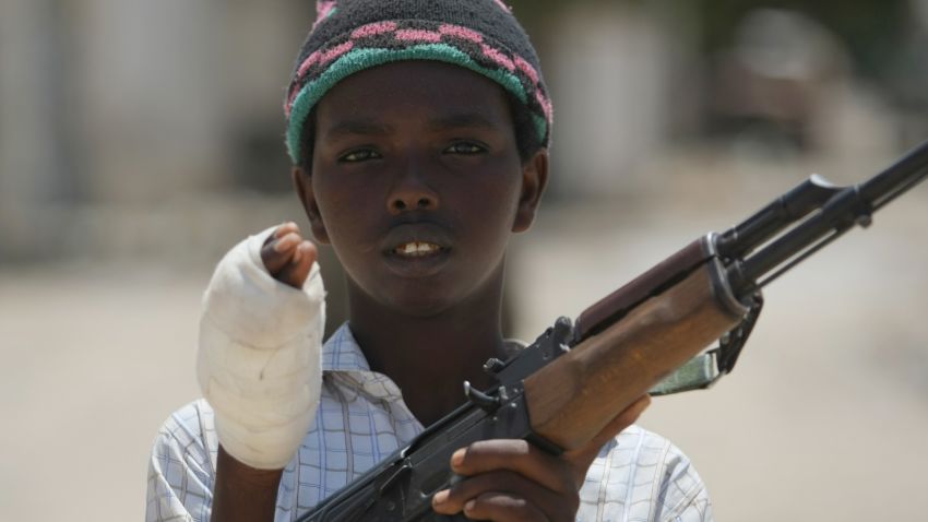 A young fighter from the Al-Shabab militia shows the wound in his hand which he suffered while battling Somali government forces in a frontline section in Sinaya Neighborhood in Mogadishu, on July 13, 2009. According to the Islamist militants, Al-Shabab fighters and Hizbul Islam fighters regained some of their position overnight which they had lost to the government soldiers over the weekend. Paramedics, police and government forces said the fighting Sunday spread across several districts of the city and claimed many lives. "The ambulances collected 75 injured civilians and 14 dead bodies of civilians," Ali Muse, the head of the city's ambulance service, told AFP. "Some of them were killed by mortar and artillery shells and others by crossfire." AFP PHOTO/Mohamed DAHIR (Photo credit should read MOHAMED DAHIR/AFP/GettyImages)