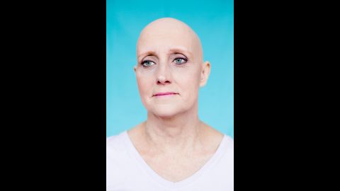 Pammy is one of the women with alopecia who posed without a wig for photographer Christoph Soeder. His "Unfading" series gave them confidence, he said: "It really emphasizes people's individuality. It just increases their uniqueness."