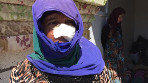 This woman was injured when the house she was in was hit by a mortar; her son, 15, was killed