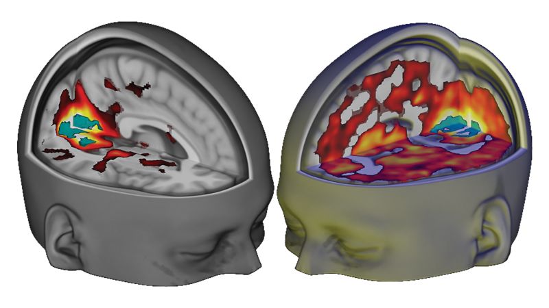 What effects does LSD have on our brain