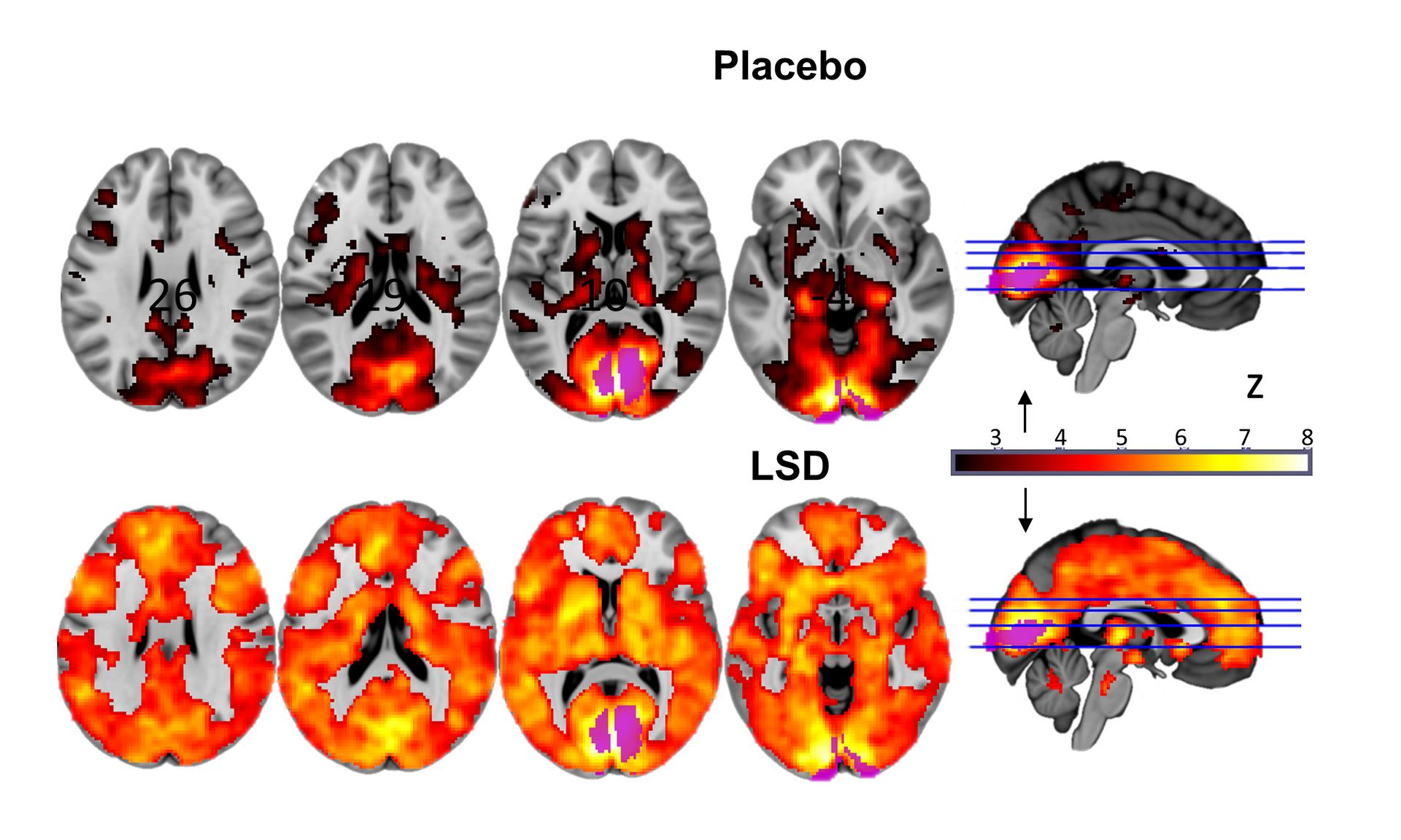 blik fjer rack This is your brain on LSD, literally | CNN