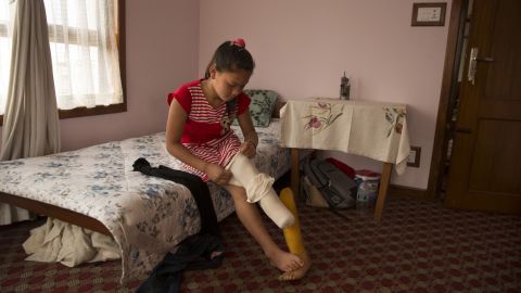Maya gets ready for school. Because she is still growing, she must periodically be fitted with a new prosthetic.