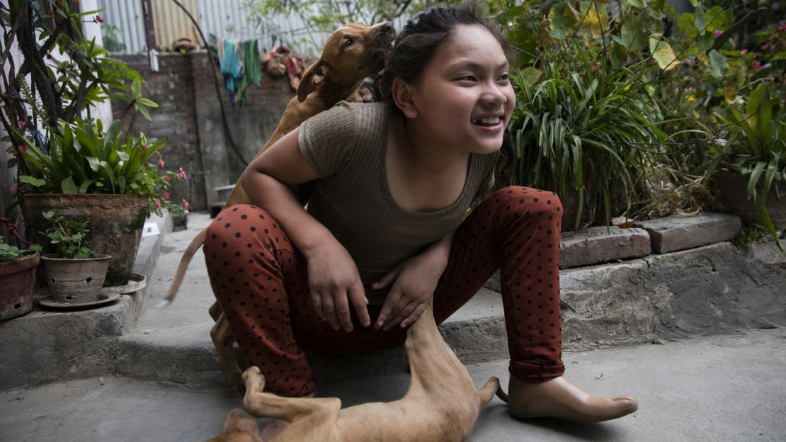 1110px x 624px - Nepal quake: One girl's remarkable recovery | CNN