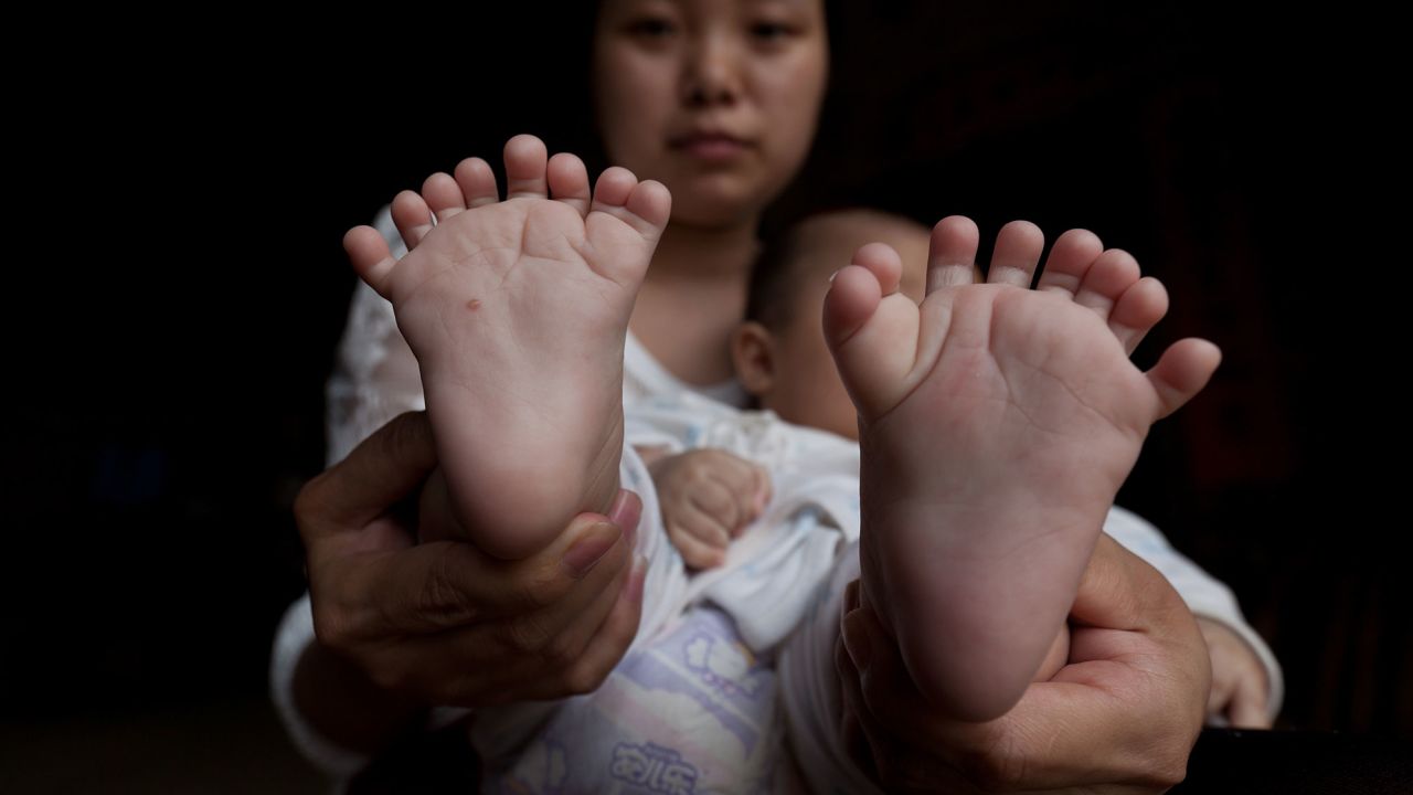 Hong Hong's mother shows her son's feet. The infant was born with 16 toes.