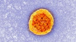 Hepatitis C virus (HCV).