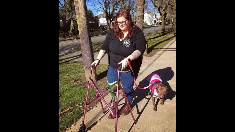 Fuggetta walks through her Portland, OR, neighborhood wearing her prosthetic limb, with her dog K.J. at her side. She adopted K.J. four months after her beloved pit bull Tina died. 