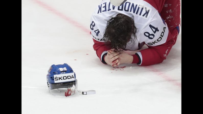 Tomas Kundratek, a Czech defenseman, bleeds onto the ice after being hit in the face against Latvia on Saturday, May 7. He received stitches and was reinserted into the lineup at the World Championships.