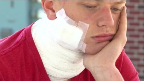 e-cigarette explodes in classmates face pkg_00000316.jpg