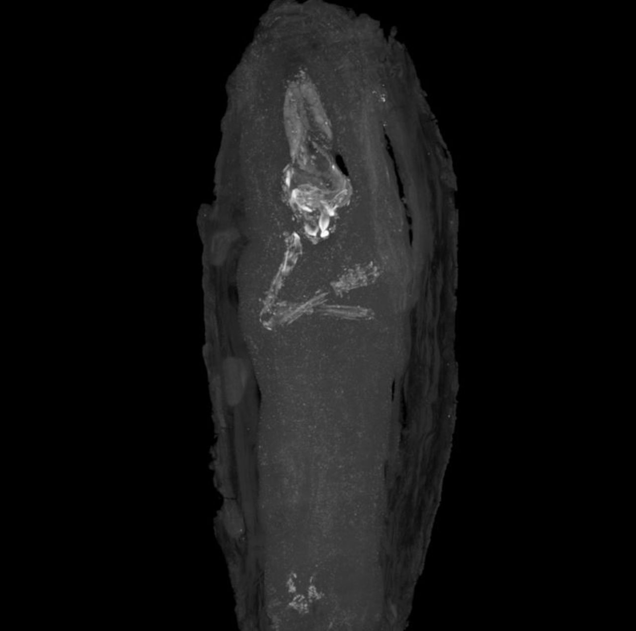 A micro CT scan revealed the first pictures of a tiny human body held within an Egyptian mummy