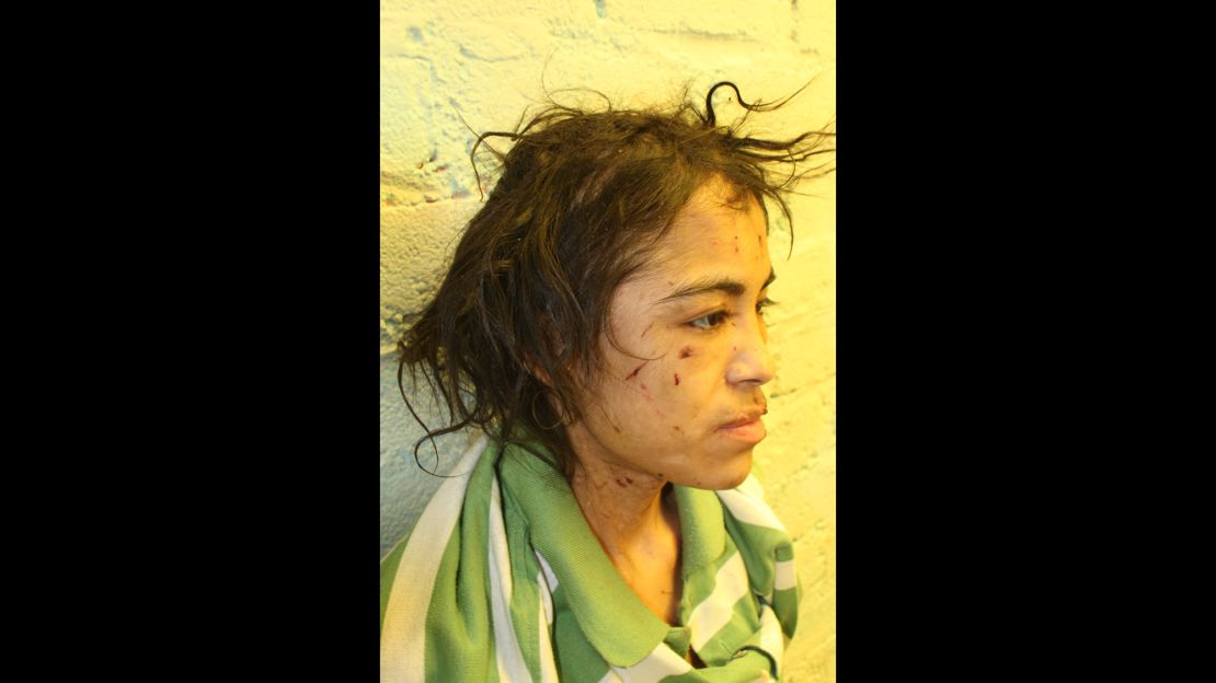 Zunduri says, in addition to being physically abused, she was also brainwashed.  The message was always the same: "You're worthless." She's shown here after her escape.
