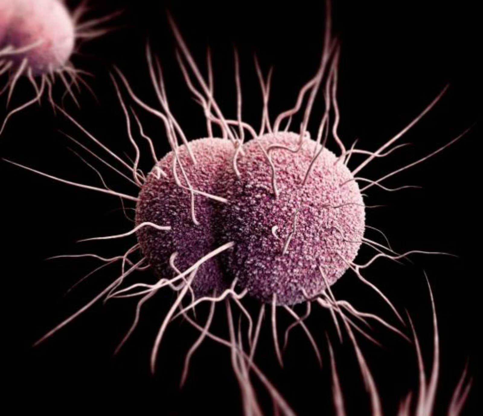 stds gonorrhea pictures