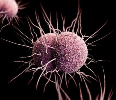 In the United States,<a href="http://www.cdc.gov/std/stats14/gonorrhea.htm" target="_blank" target="_blank"> over 350,000 cases</a> of this sexually transmitted infection were reported in 2014, caused by the bacterium Neisseria gonorrhoeae. Resistance to antibiotics began to occur soon after their introduction in the 1930s and has continued to rise with resistance now seen against at least five of the drugs once used to treat it -- which include the commonly used antibiotics penicillin and tetracycline.