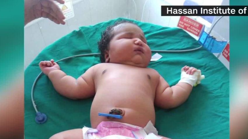 15 pound baby india daily hit newday_00005901.jpg